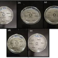 Image result for Argyrolobium tuberosum