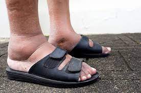 Melansir laman wagwalking.com, hal ini dapat diketahui permasalahan medis berkaitan dengan alat gerak kucing, terutama bagian kaki. Kaki Mendadak Bengkak 6 Hal Ini Bisa Jadi Penyebabnya