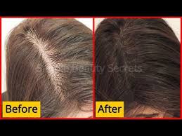 My Grandmother Secret To Regrow Hair From Roots Double Your Hair Growth Grow Long Hair Youtube Regrow Hair Grow Long Hair Hair Growth