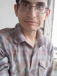 How to identify someone, get your cameras ready!, Vein patterns, veins in  the arm are the same, however the anatomical arrangement, size, visibility  may vary. , H-pattern, M-Pattern, Atypical Pattern, ...