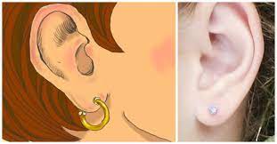 What Is Ear Cheese And How Can We Get Rid Of It Littlethings Com