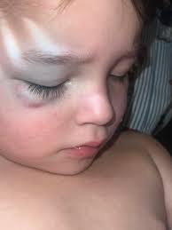 I work with Molly. Our kids go to school together. She's a hard worker and  an amazing Mother. Reese is an awesome kid and has faced so many challenges  but that doesn't