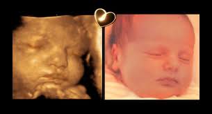 Live 4d ultraschall video von meiner frauenarzt untersuchung in der ssw 20. Baby 3d Ultraschall Studio Babyfacing De Beitrage Facebook