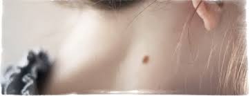 Rodinka Na Shee Znachenie Malenkie Pyatnyshek