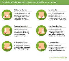 Typisch für die akutphase ider blinddarmentzündung st, dass die schmerzen besonders beim laufen plötzlich stärker werden. Blinddarmentzundung Schnell Erkennen Und Handeln