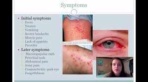 Use of antibiotics other than doxycycline is associated with a higher risk of fatal outcome from rmsf. Rocky Mountain Spotted Fever Youtube