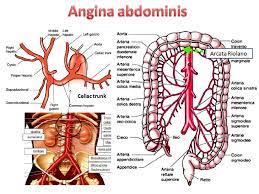 Sindrome arteria mesenterica superiore 3. Insufficienza Arteriosa Viscerale Ed Occlusione Acuta Dell Arteria Mesenterica