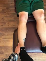 Image result for Femoral Retroversion