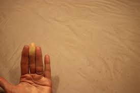 Cold Feet It Could Be Raynaud S
