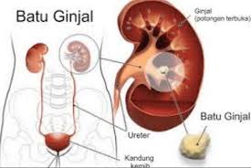 Asupan nutrisi tersebut berasal dari berbagai makanan yang kita konsumsi. Penyakit Pada Sistem Reproduksi Dan Cara Pencegahannya