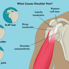 The shoulder anatomy includes the anterior, lateral & posterior deltoids, plus the rotator cuff. Anatomy Of The Human Shoulder Joint