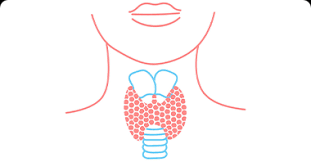 Your doctor may recommend periodic blood tests or thyroid scans to check for signs of a thyroid cancer recurrence. Thyroid Cancer Symptoms Causes And Treatment