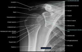 Xray examination of the clavicle radiography of clavicle is routinely done in radiology department in both ap and ap axial projection. Shoulder Pectoral Girdle Shoulder Girdle Radiography Human Anatomy Glenohumeral Joint Shoulder Joint Acromion Medical Anatomy Radiography Radiology