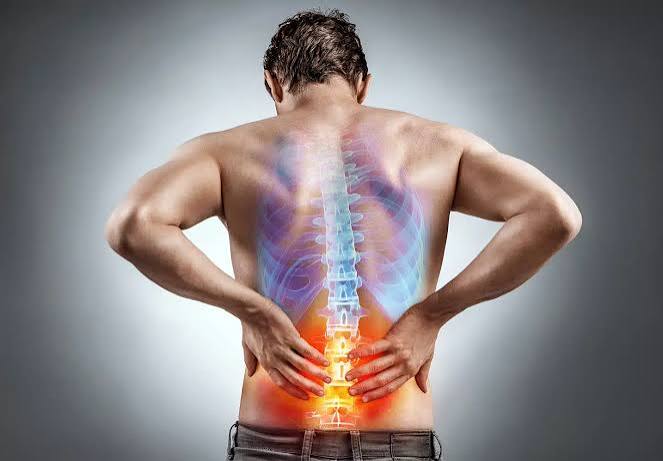 Herniated Disc Treatment: Causes, Symptoms, and Effective Recovery Options