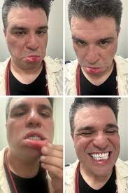 Vladimir Gómez: Testimonio de golpiza que lo llevó a cirugía