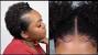 Easy Black Hairstyles For Medium Hair