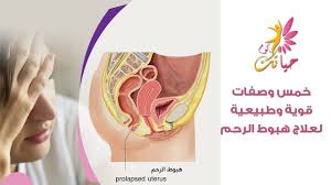 خمس وصفات قوية وطبيعية لعلاج هبوط الرحم Youtube