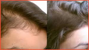 La Vitamine E Fait Vraiment Pousser Les Cheveux 2x Plus Vite Haare Pflegen Haar Und Beauty Haare