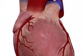 The two main branches are the left coronary artery (lca) and right coronary artery (rca). Quiz Heart Coronary Arteries Advanced Anatomytool