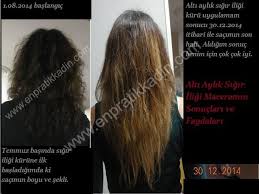 Sigir Iliginin Sacimda Yaptigi Degisimler Sac Guzellik Sac Bakimi