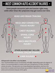 Check spelling or type a new query. Auto Accidents When The Minor Aches Become Major Pains Discover Health And Wellness