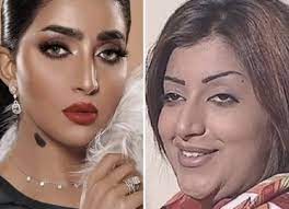 نشرت الإعلامية الكويتية مي العيدان ، فيديو تؤازر فيه الفنانة المصرية منى عبد المجيد، التي تعيش في دولة الكويت، وتعاني من الإصابة بالشلل بسبب عمليات التجميل. Ù…ÙŠ Ø§Ù„Ø¹ÙŠØ¯Ø§Ù† Ø¹Ù† Ø¨Ø«ÙŠÙ†Ø© Ø§Ù„Ø±Ø¦ÙŠØ³ÙŠ Ù‚Ø¨Ù„ ÙˆØ¨Ø¹Ø¯ Ø§Ù„ØªØ¬Ù…ÙŠÙ„ Ø§Ù„Ù„Ù‡ ÙŠØ¹Ø² Ø§Ù„ÙƒÙˆÙŠØª Ø¬Ø±ÙŠØ¯Ø© Ù†ÙˆØ±Øª