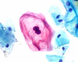 Check the neck for lumps. Qiagen And Biontech To Develop Test For Head And Neck Cancer