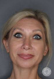 Medical Aesthetics Gallery