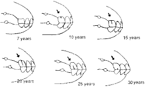 Horse Teeth Age Chart Level 2 Horse Age Draft Horses