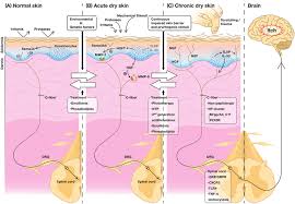 Image result for Dry Skin Management