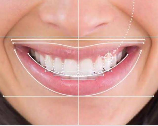 Smile Designing Treatment in Sus, Pune product image