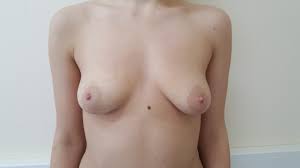 Треугольная грудь - 51 снимков форм