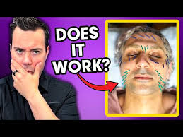 We Did The Research On Acupuncture So You Don't Have To