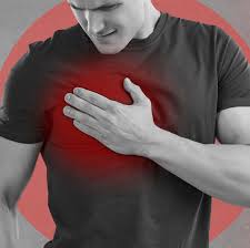 Image result for Chest Pain