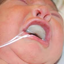 To be in a position to do something estar en condiciones de hacer algo. Feeding Plate Obturator In Position Download Scientific Diagram