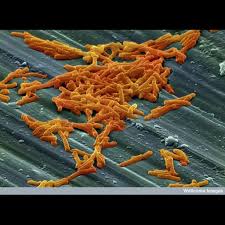 Image result for Clostridium