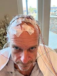 I'm more machine now than man. Just kidding my brain is messed up from the  accident so I will be wearing this until Saturday. I couldn't shower  beforehand because they had to