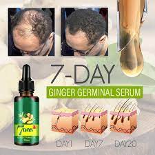 Try one of these 10 best hair serums, from brands like ogx and oribe. 7 Day Ginger Germinal Serum Hair Regrowth Hair Loss Hair Loss Remedies