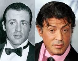 Matthew mcconaughey, kevin costner, robbie williams e john travolta. Centri Protesi Capelli Italia Protesi Capelli Attori