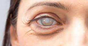 Pin On Eyes