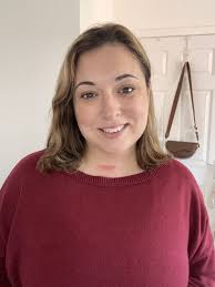 Mum, 36, nearly died when 'forceful' YAWN broke her neck