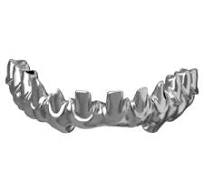 High Posterior Column Supra-arcuate Line Locking Plate ...