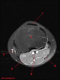 This section of the website will explain large and minute details of sagittal knee cross sectional anatomy. Atlas Of Knee Mri Anatomy W Radiology