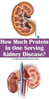 Chronic Renal Failure Kidney Disease Renal Disease Polycystic Kidney Disease