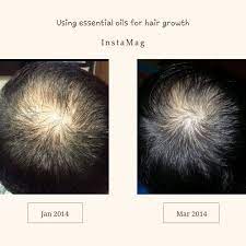 Keep reading this information to discover the stunning energy of lavender for your hair. Hair Growth Success Essential Oils For Hair Essential Oils Rosemary Essential Oils