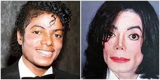 12 Celebrity Men With Bad Plastic Surgery Bad Plastic Surgeries Plastic Surgery Gone Wrong Celebrity Plastic Surgery