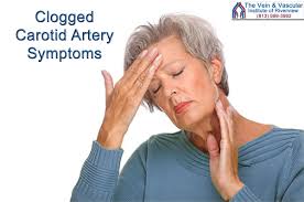 There are two large arteries in the neck, one on each side. Clogged Carotid Artery Symptoms If You Have Blockage In Your Carotid Arteries You May Experience The Following Symptoms Carotid Artery Arteries Vein Clinic