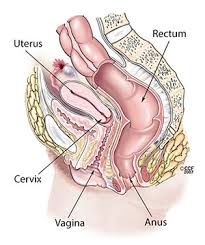 He said that sometimes they can't tell but it's 99% that it's a fibroid. Abnormal Uterine Bleeding