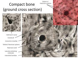 Bone, haversian system, lacunae, matrix, collagen type i, inner circumferential lamellae, outer circumferential lamellae, volkmanns canals, lamellae, osteocytes. Medical School Histology Images Of Compact Bone Ppt Download