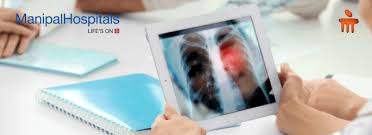 Later, it often causes coughing, wheezing, and chest pain. Manipalhospitals